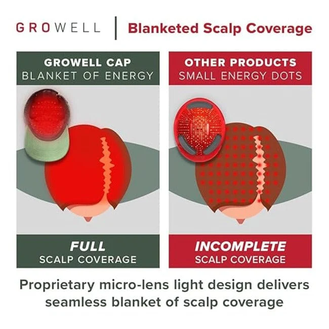 GroWell Soft Cap Hair Growth System, Red Light Therapy for Hair Loss & Regrowth, FDA Cleared, For Thinning Hair & Alopecia, Pink Cap - Image 4